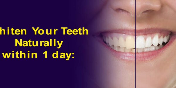 Yellow Teeth Cleaning Tips at home